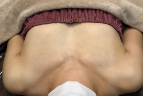 ミラクルバスト施術 30代 リピーター様
