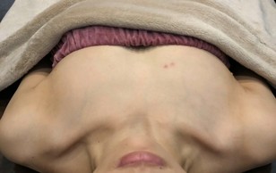 ミラクルバスト施術 30代 リピーター様