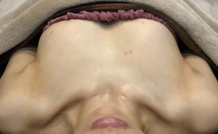 ミラクルバスト施術 30代 リピーター様