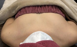 ミラクルバスト施術 30代 リピーター様