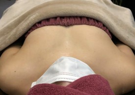 ミラクルバスト施術 30代 リピーター様