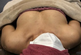 ミラクルバスト施術 40代 リピーター様