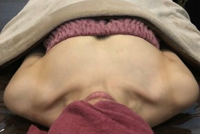 ミラクルバスト施術 30代 リピーター様