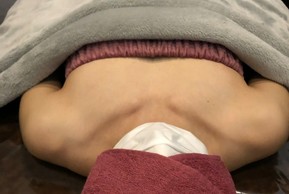 ミラクルバスト施術 30代 リピーター様