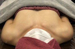 ミラクルバスト施術 30代 リピーター様