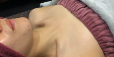 ミラクルバスト施術 20代