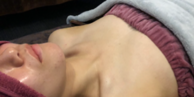 ミラクルバスト施術 20代