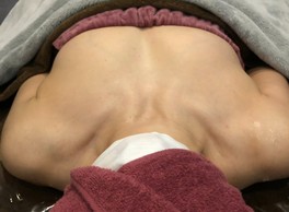 ミラクルバスト施術 40代 リピーター様