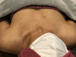 ミラクルバスト施術 40代 リピーター様