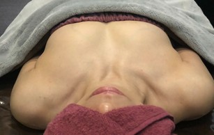 ミラクルバスト施術 40代 リピーター様