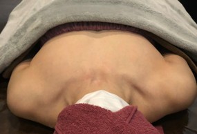 ミラクルバスト施術 40代 リピーター様
