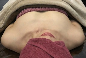 ミラクルバスト施術 40代 リピーター様