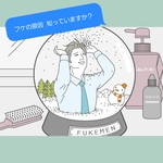 ♡フケの原因は頭皮の乾燥ではなく皮脂です♡